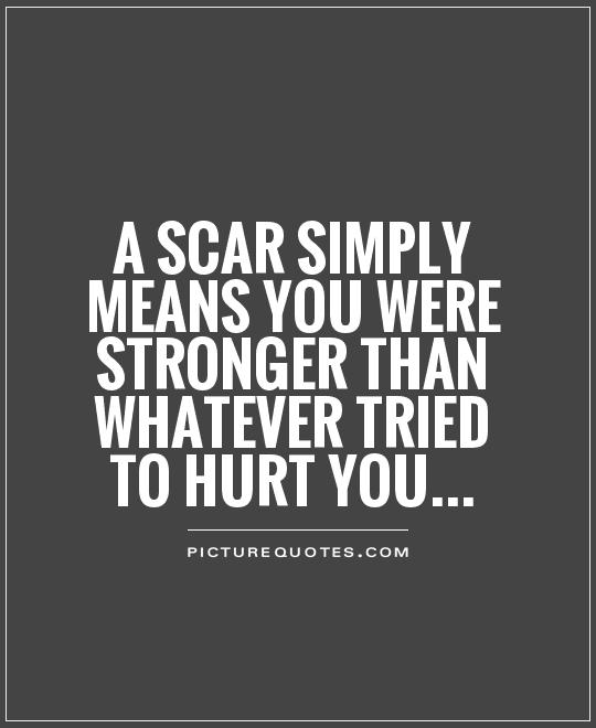 a-scar-simply-means-you-were-stronger-than-whatever-tried-to-hurt-you-quote-1
